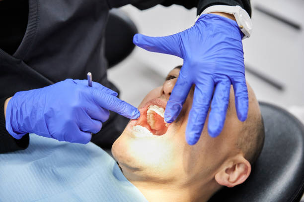 Best Emergency Dental Care for Sports Injuries in Gateway, FL